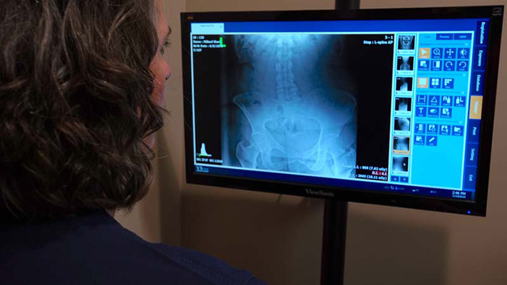 Chiropractor Omaha NE Sheri Millard With X Ray